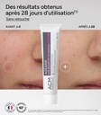ACM/ Azeane - Azelaic Acid 15% 30ml :كريم ازيان بتركيز 15% الازيلك اسيد من اي سي ام