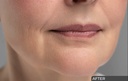 Ceuticoz/ CEUTOX Retinol 0.1% Cream Serum 30ml: سيتيكوز سيروم الريتنول بتركيز ٠.١٪؜ لمعالجة التصبغات ومنع التجاعيد