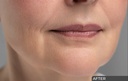 Ceuticoz/ CEUTOX - ADV serum 30ml: سيتيكوز كريم لتجديد البشرة ومكافحة الشيخوخة