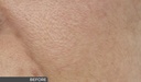 Ceuticoz/ IVORINE - Enzymatic Serum 30ml: سيتيكوز سيروم ايفورين انزيمي لتجديد البشرة