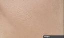Ceuticoz/ IVORINE - Enzymatic Serum 30ml: سيتيكوز سيروم ايفورين انزيمي لتجديد البشرة