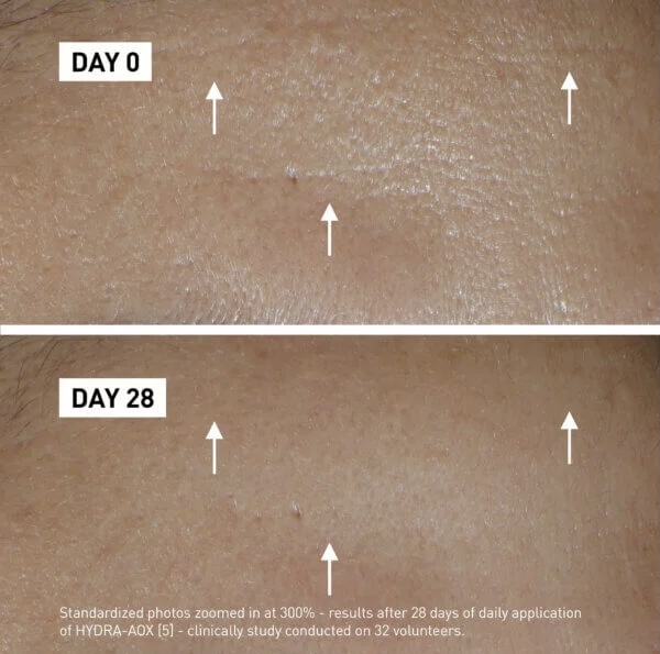 FILORGA/ HYDRA-AOX 5  Intensive Antioxidant Serum 30ml :