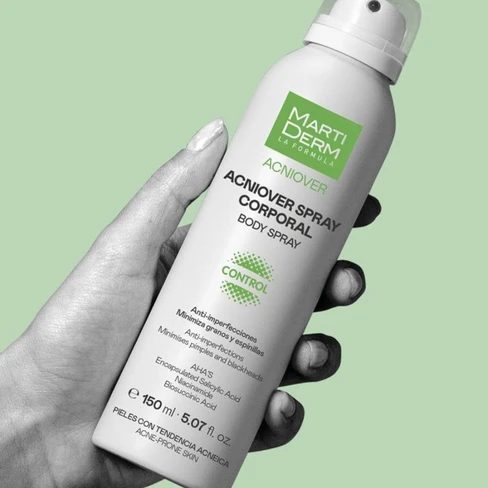 MARTIDERM/acniover spray corporal-بخاخ مضاد لحب الشباب واثاره عالجسم 